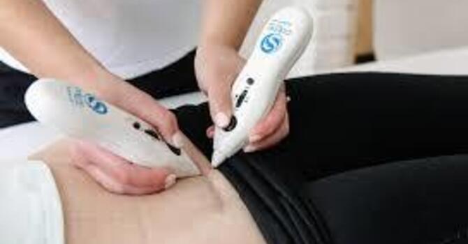 C-Section Scar Therapy: Why It Matters & How It Helps image